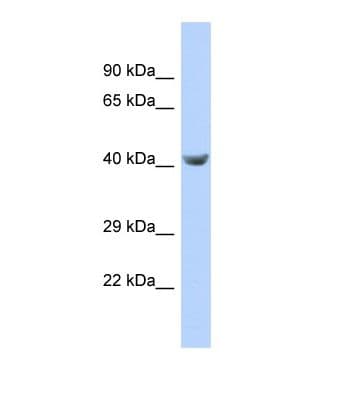Polyclonal Rabbit anti-Human TPTE Antibody (aa307-356, WB)