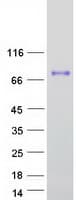 Human HRG Protein (Recombinant Myc-DDK (Flag))