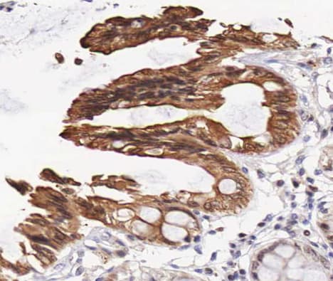EGFR Antibody (phospho-Thr693)