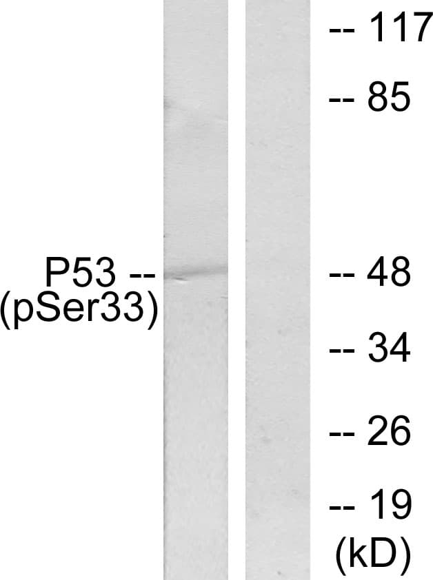 TP53 / p53 Antibody (phospho-Ser33)