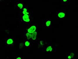 Monoclonal Mouse anti-Human DNTTIP1 / TDIF1 Antibody (clone OTI1F4, IHC, IF, WB)