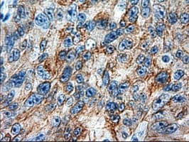 KRT18 / CK18 / Cytokeratin 18 Antibody (clone OTI1E1)