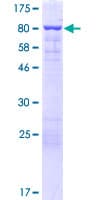 Human EPS8L3 Protein (Recombinant GST)