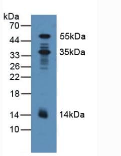 PDXK / PNK Antibody (aa29-253, Biotin)