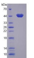 Human CAMK1 / CAMKI Protein (Recombinant)