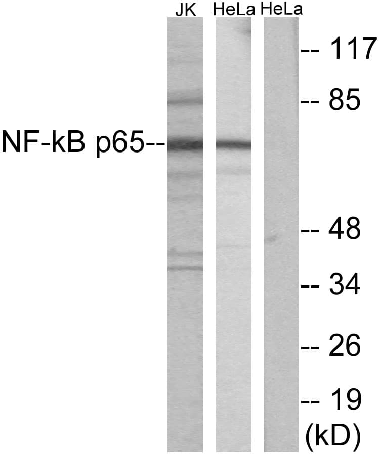 RELA / NFKB p65 Antibody (aa496-545)