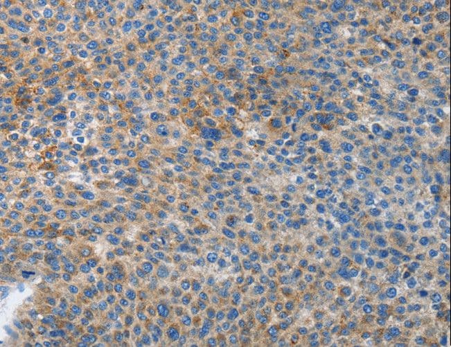 APG4B / ATG4B Antibody