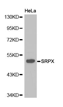SRPX Antibody
