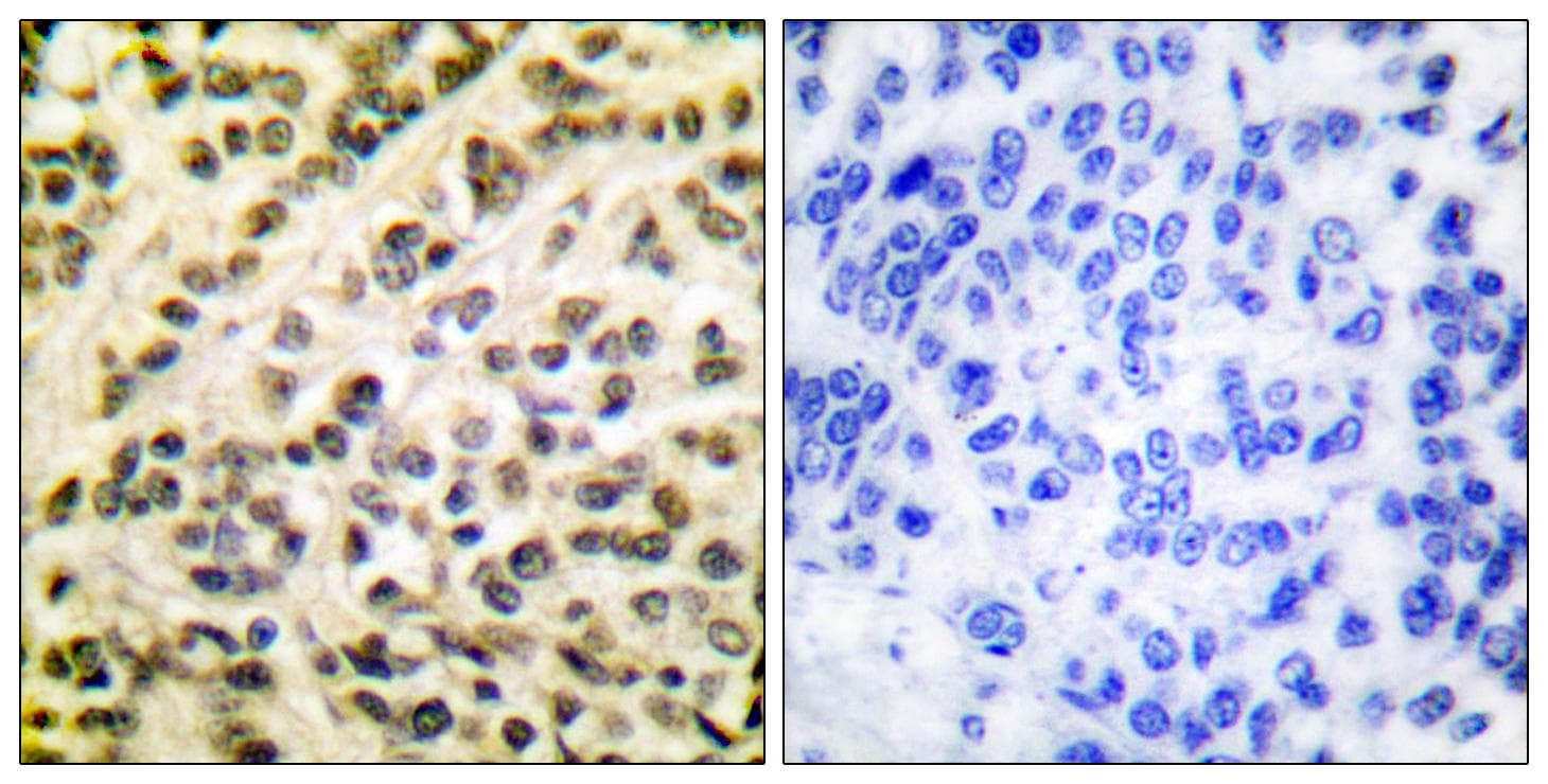 FLI1 Antibody