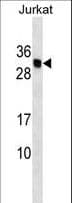 Polyclonal Rabbit anti-Human HLA-DMB Antibody (aa127-154, WB)