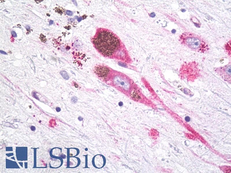 IHC-plus™ Polyclonal Rabbit anti-Human MC1R Antibody (Cytoplasmic Domain, IHC)