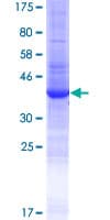 Human EPGN / Epigen Protein (Recombinant GST)