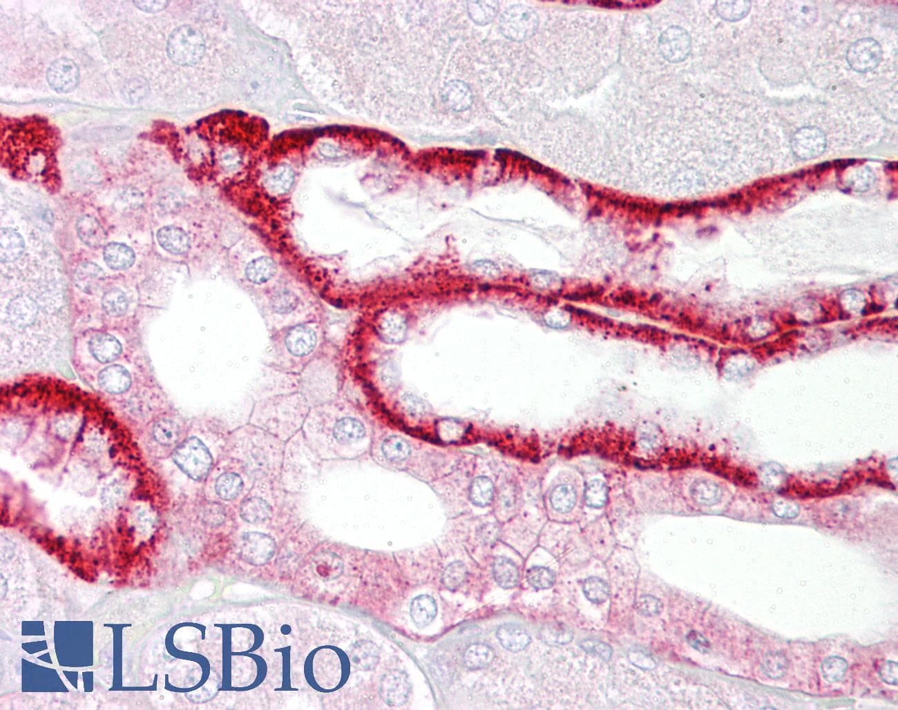 Polyclonal Rabbit anti-Human CDH16 / Cadherin 16 Antibody (aa151-200, IHC, WB)