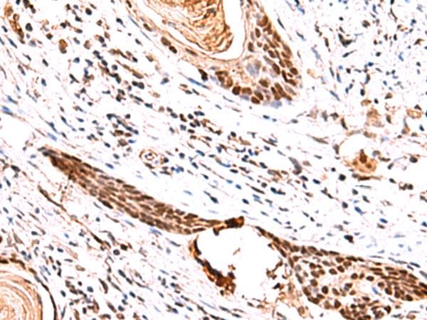 IRF2BP1 Antibody