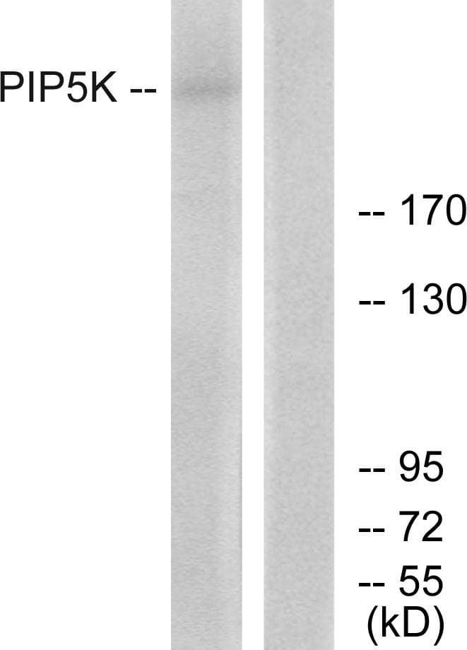 Polyclonal Rabbit anti-Human PIKFYVE / PIP5K Antibody (IF, WB)