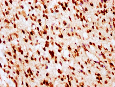 Polyclonal Rabbit anti-Human HIST1H2BN Antibody (IHC, IF)