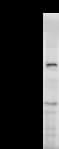 SNAPC4 Antibody (clone SNAAD17A)