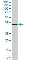 SLIM / FHL1 Antibody (clone 2A9)