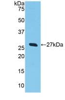 GSTA2 Antibody (aa1-222)