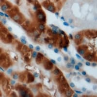 Polyclonal Rabbit anti-Human CPT2 Antibody (IHC, IF, WB)