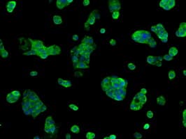SORD / Sorbitol Dehydrogenase Antibody (clone OTI17E7)