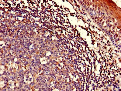 Polyclonal Rabbit anti-Human ASCC1 Antibody (IHC)