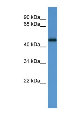 MLR2 / LCOR Antibody (aa203-252)
