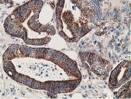 Monoclonal Mouse anti-Human SSX1 Antibody (clone OTI2F8, IHC, IF, WB)
