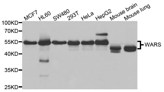 WARS Antibody