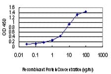 MYO7A / Myosin-VIIa Antibody (clone 1D3)