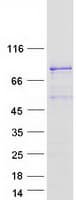 Human MTDH / Metadherin Protein (Recombinant Myc-DDK (Flag))