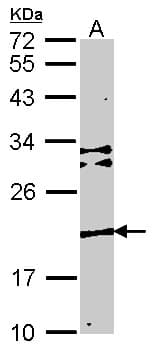 TMEM147 Antibody (aa37-131)