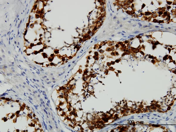 Monoclonal Mouse anti-Human DAZ1 / DAZ Antibody (clone 3E3, IHC, WB)