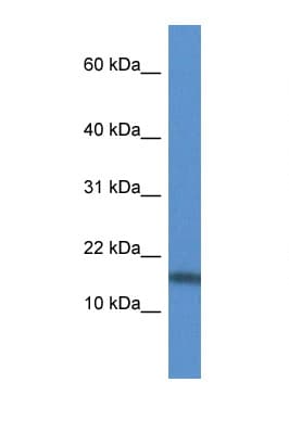 TNFSF13 / APRIL Antibody (aa85-134)