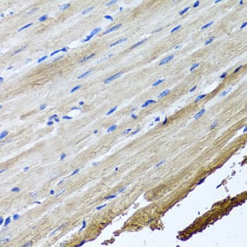 KIAA0153 / TTLL12 Antibody