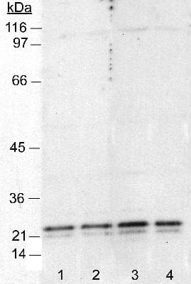 CAV1 / Caveolin 1 Antibody (clone 7C8, DY488)