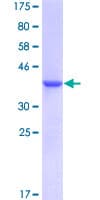 Human S100A13 Protein (Recombinant GST)