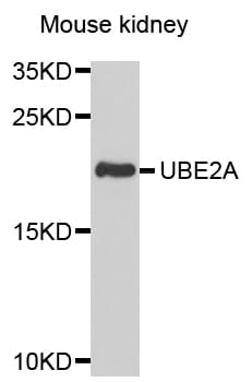 UBE2A Antibody