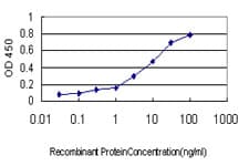 MAGEA8 Antibody (clone 3F7)
