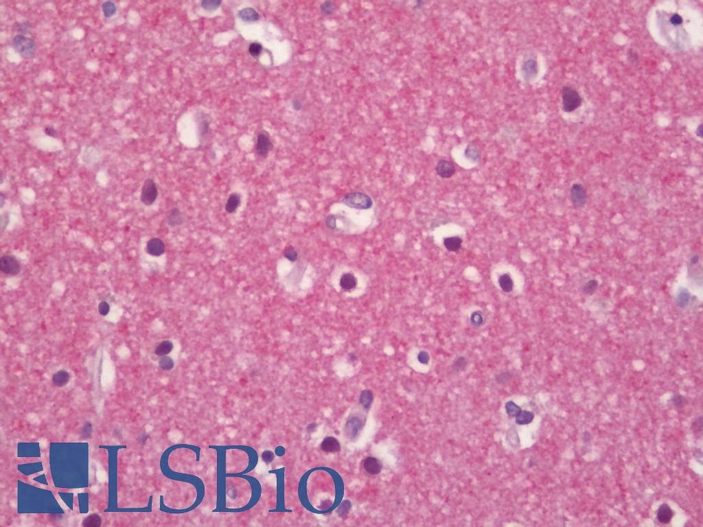 IHC-plus™ ADGRB1 / BAI1 Antibody (aa683-732)