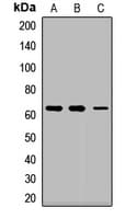 Polyclonal Rabbit anti-Human NARS Antibody (WB)
