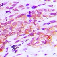 KIAA1456 / C8orf79 Antibody