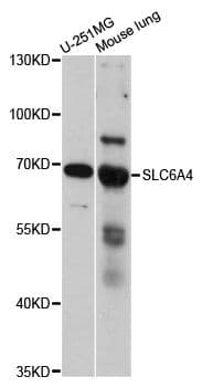 SLC6A4 / SERT Antibody