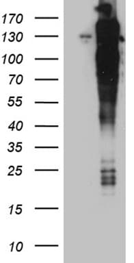 Monoclonal Mouse anti-Human ARHGEF18 Antibody (clone OTI4B5, aa118-215, WB)