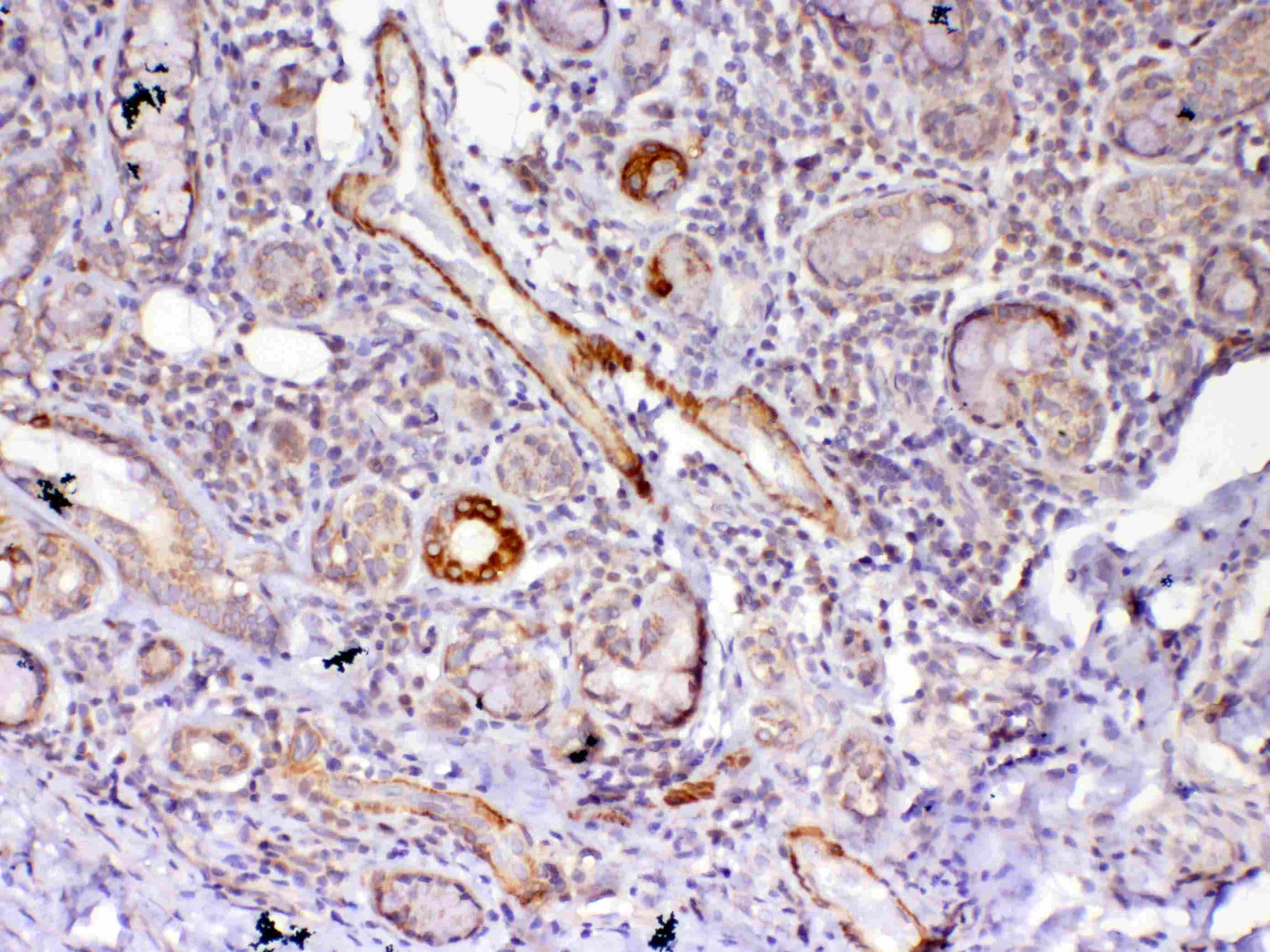 FZD4 / Frizzled 4 Antibody