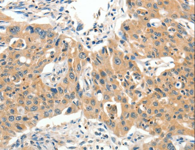 Polyclonal Rabbit anti-Human SLC11A2 / DMT1 Antibody (IHC)