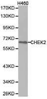 CHEK2 / CHK2 Antibody
