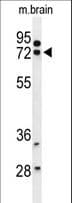 IHC-plus™ HSPA12A Antibody (aa398-427)