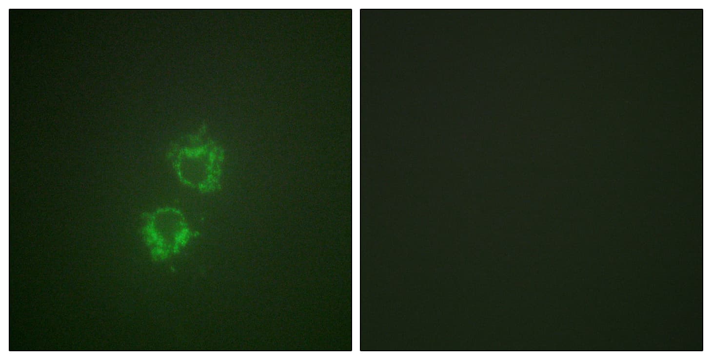 Polyclonal Rabbit anti-Human YWHAQ / 14-3-3 Theta Antibody (phospho-Ser232, IHC, IF, WB)
