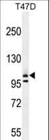 Polyclonal Rabbit anti-Human COL1A2 / Collagen I Alpha 2 Antibody (aa16-43, WB)